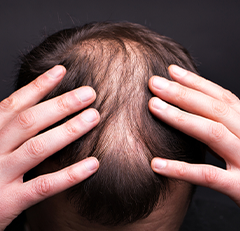 concern-hair-hairloss (Roots)-breakage