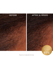 Moroccanoil Revitalizing Scalp Tonic 100ml – clinical results