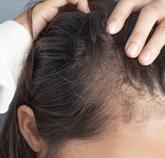 concern-hair-sensitive-scalp-damaged Hair