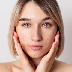 concern-skin-open-pores